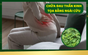 Chữa đau thần kinh tọa bằng ngải cứu